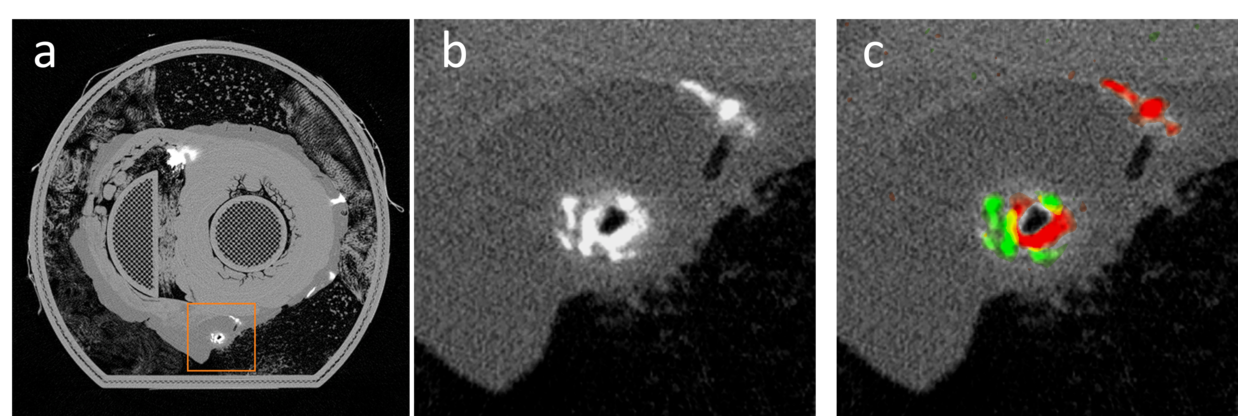 Adapted from Grönberg et al. Eur. Radol. 2020